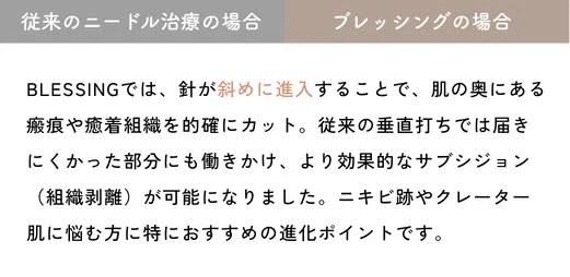 ポイント1の説明